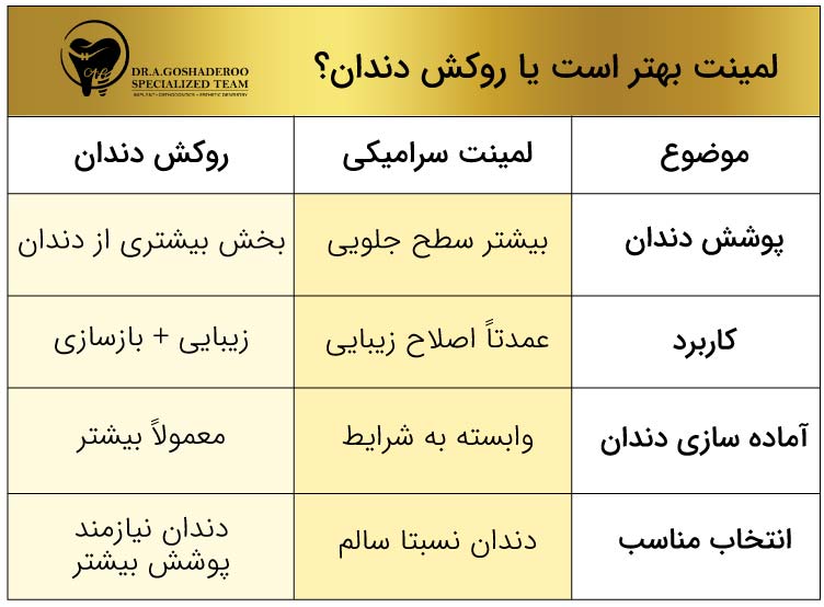 لمینت بهتر است یا روکش دندان؟